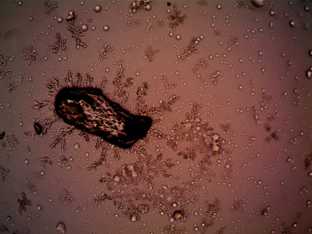 Man Produces Sperm from Frozen Testicular Tissue in Groundbreaking Trial