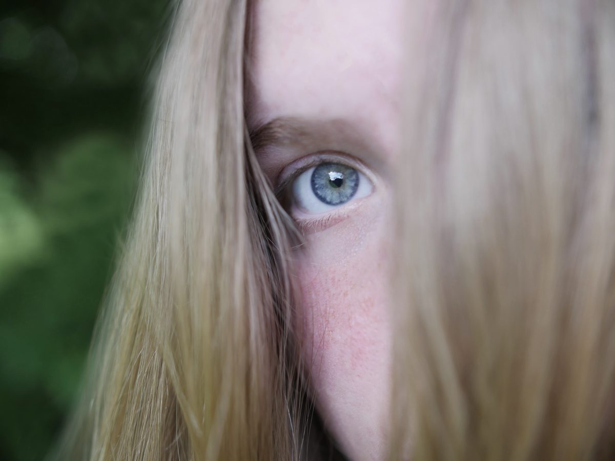 Eclipse Warning: Signs of Eye Damage After Viewing the Sun Without Protection